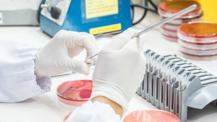 Scientist using petri dish