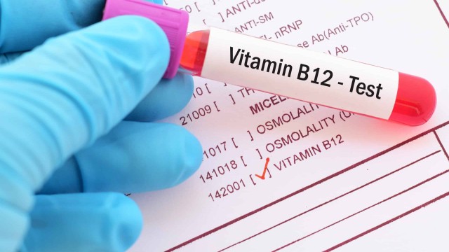 Vitamin B12