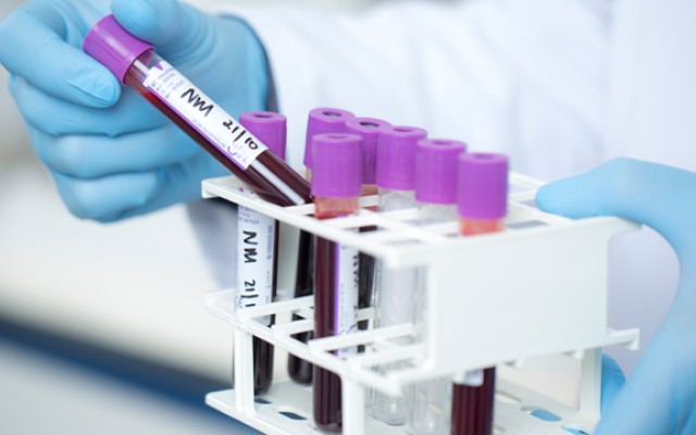 Vials of blood