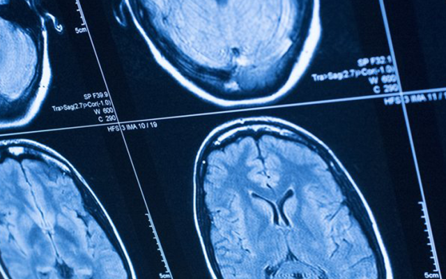 brain scan