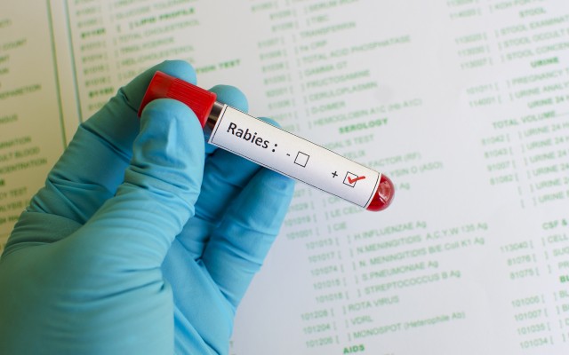 Blood sample with rabies virus positive