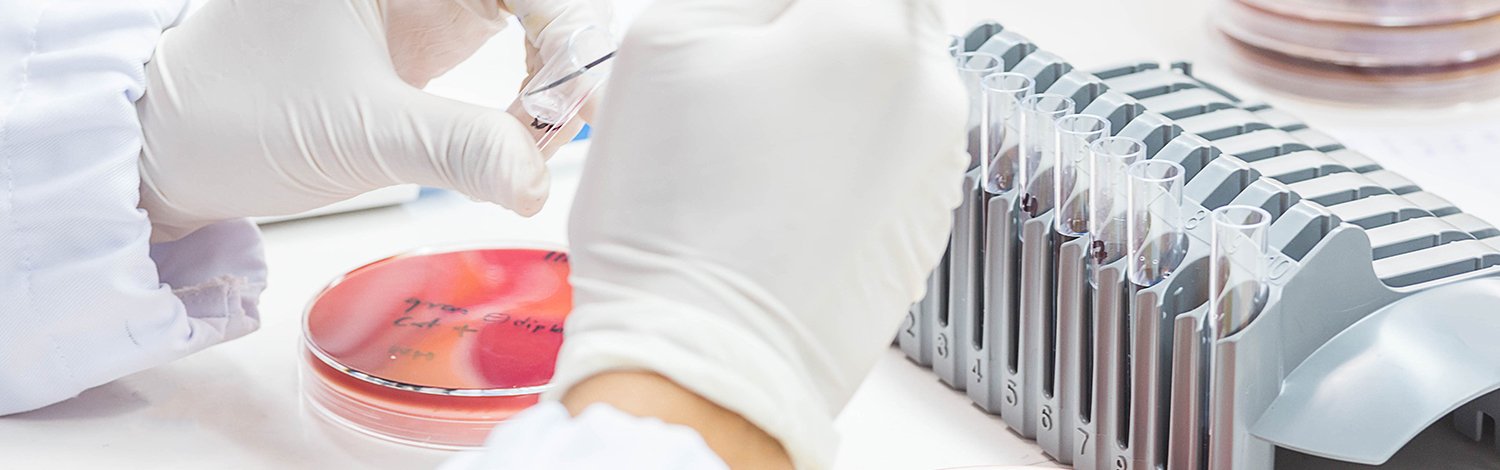 Close up on the hands of a medical technician working on bacterial culture and drug resistance of pathogens in laboratory.