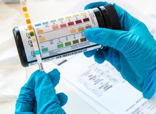 Gloved hands are holding a pH strip