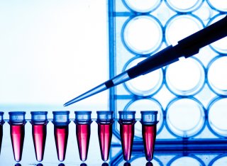 Igenomix PCR test