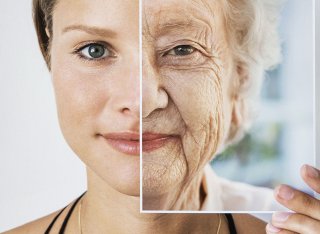 Vascular Aging