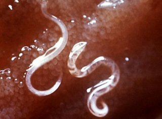Zoonotic transmission of intestinal parasites