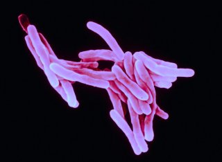 The role of central carbon metabolism in tuberculosis bacillus in the human host and the translation of this knowledge into anti-tuberculosis compounds | Microbial Metabolism