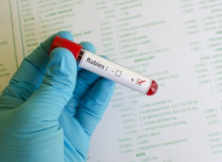 Blood sample with rabies virus positive