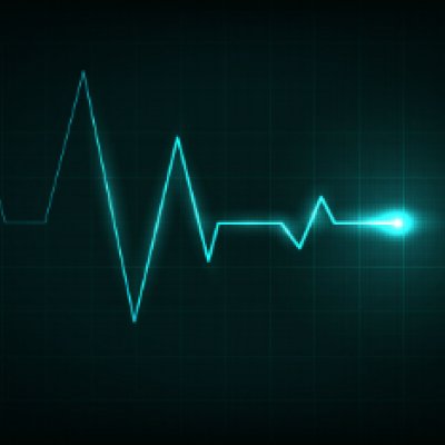 Heart rate