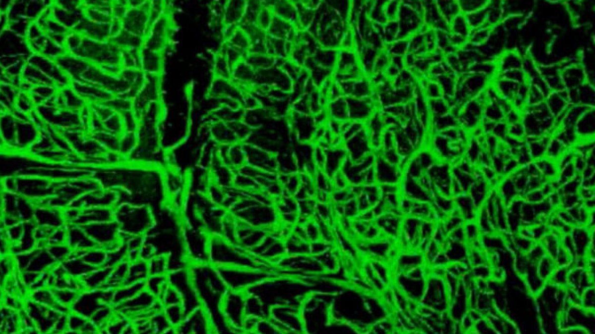 green 3d blood vessels