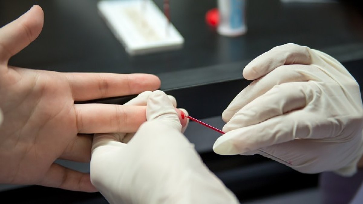 HIV blood test carried out on hand