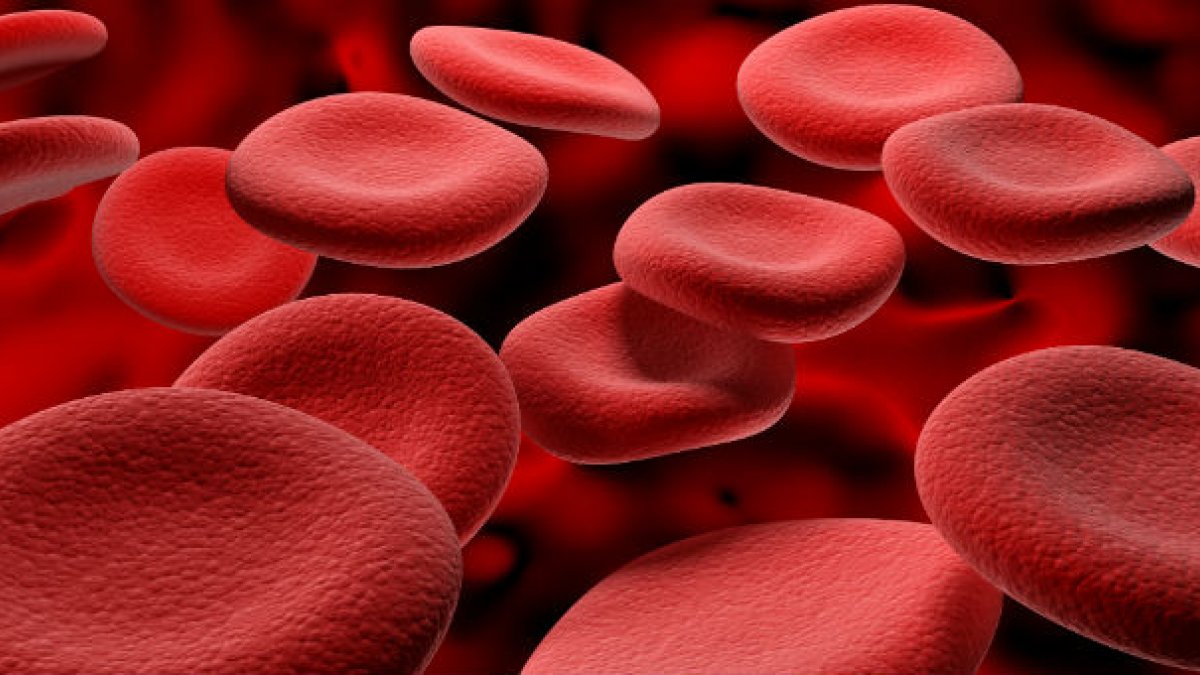 large red blood cells
