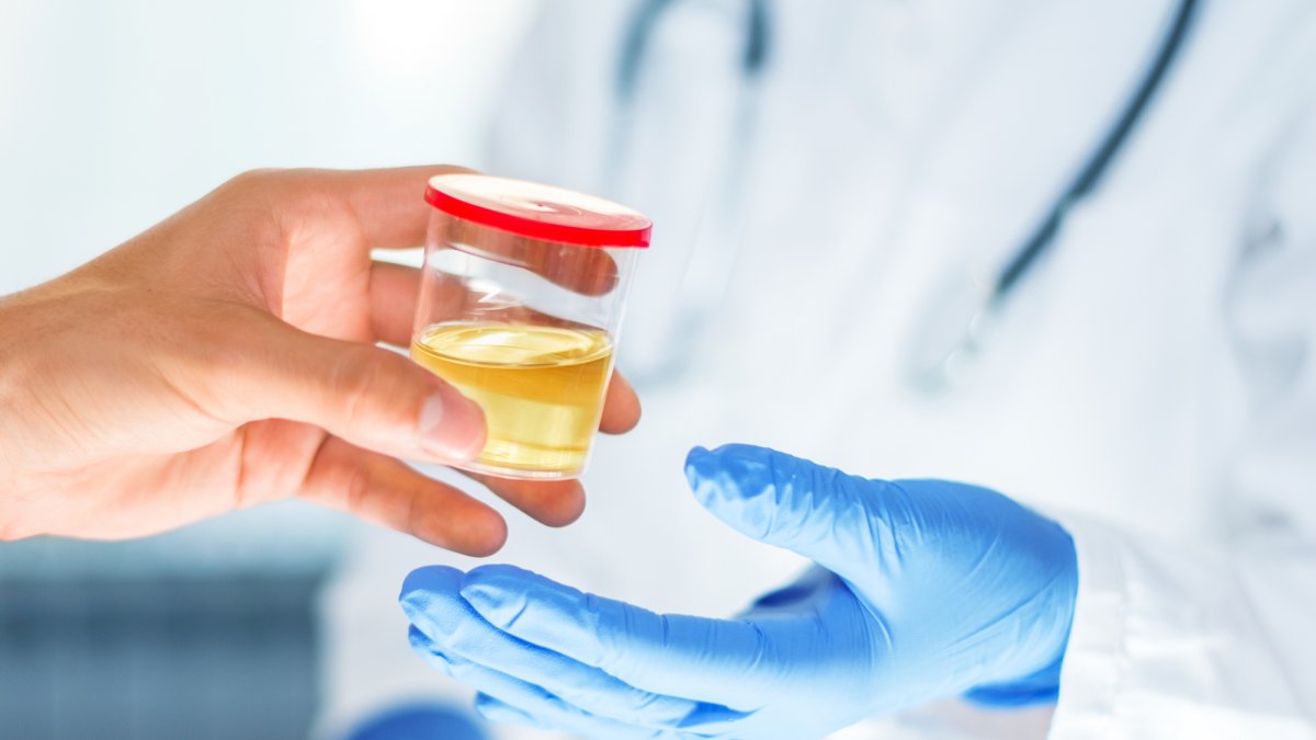 Person handing over urine sample to medical professional