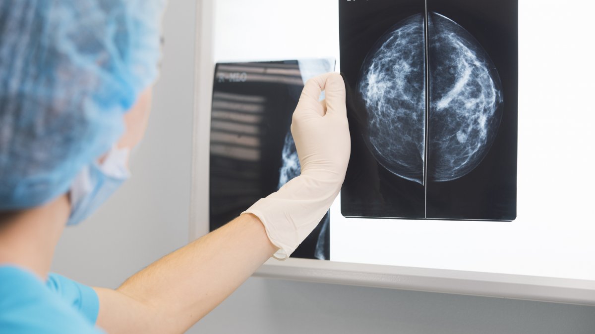 Nurse looking at x-ray of head
