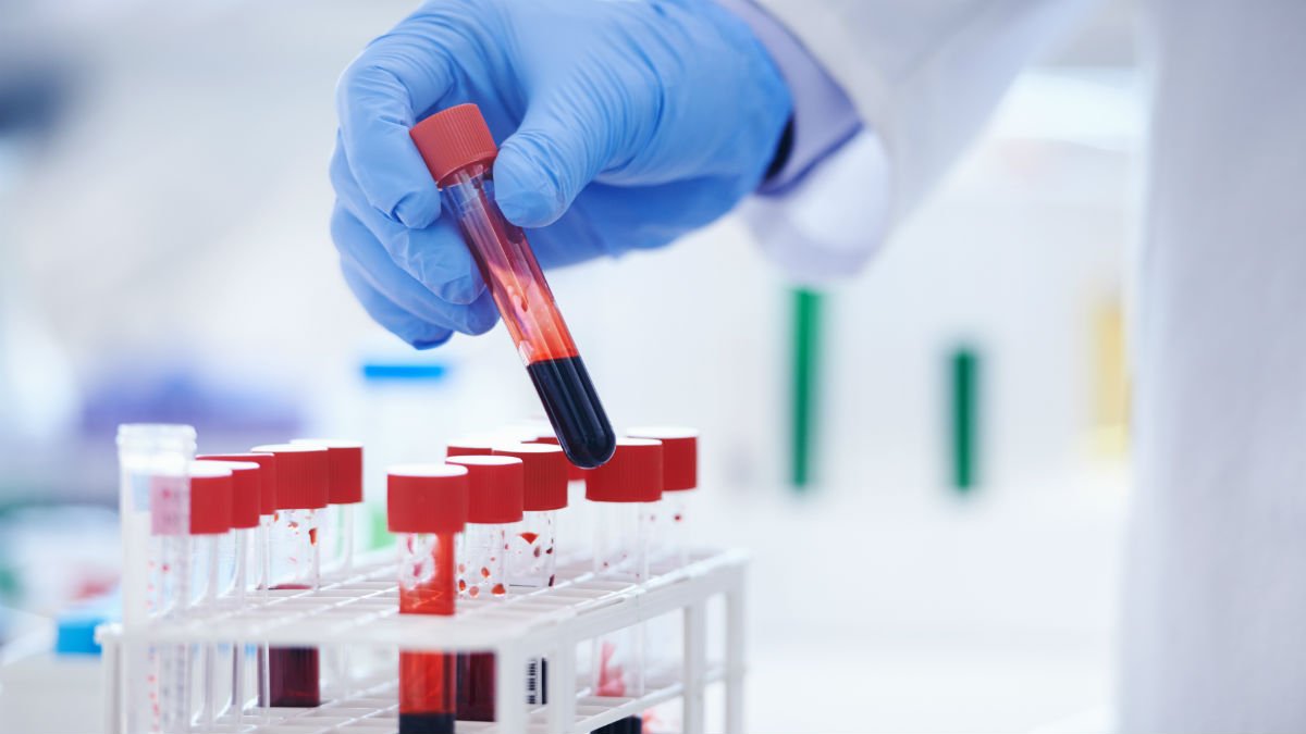 How to Get Chlamydia Tested at a Healthcare Provider How to Get Chlamydia Tested at a Healthcare Provider