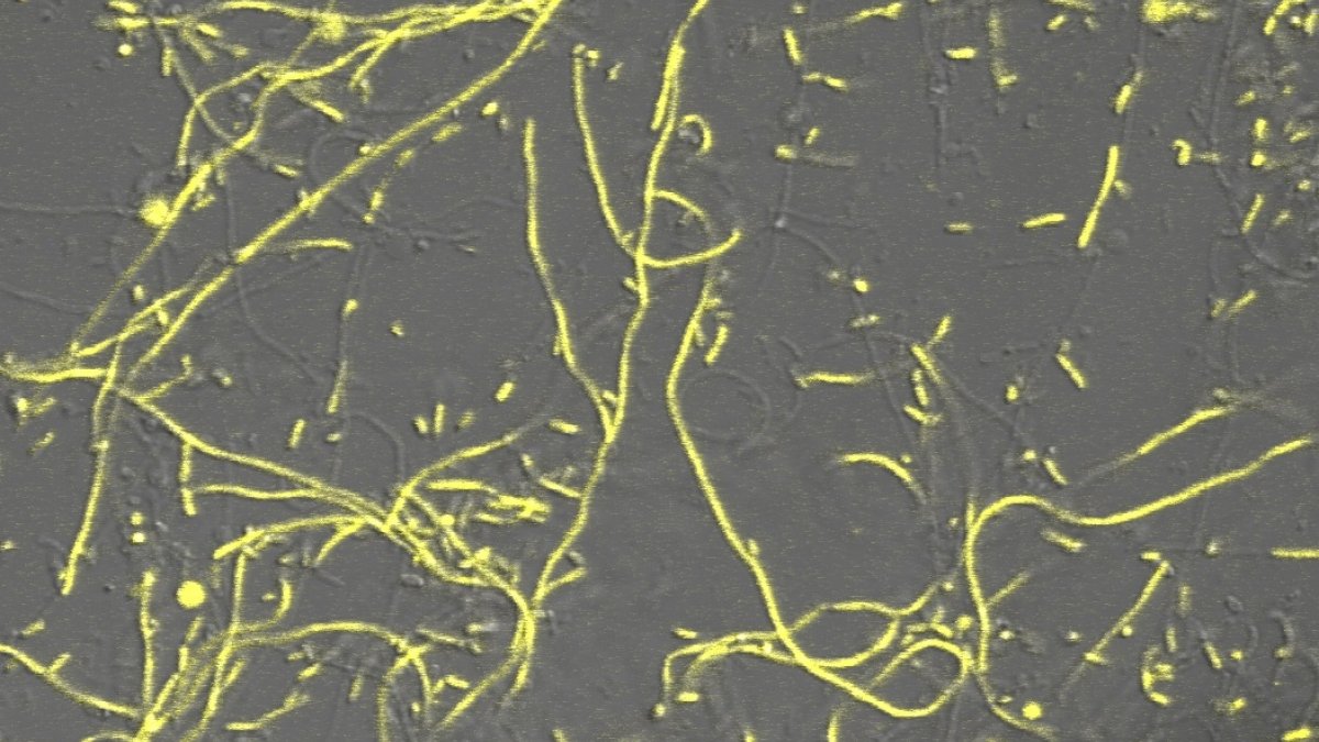EColi image