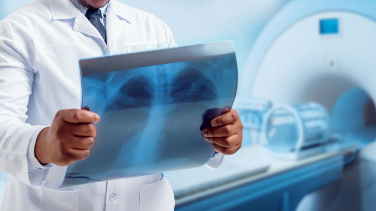 Radiotherapy_PR_19