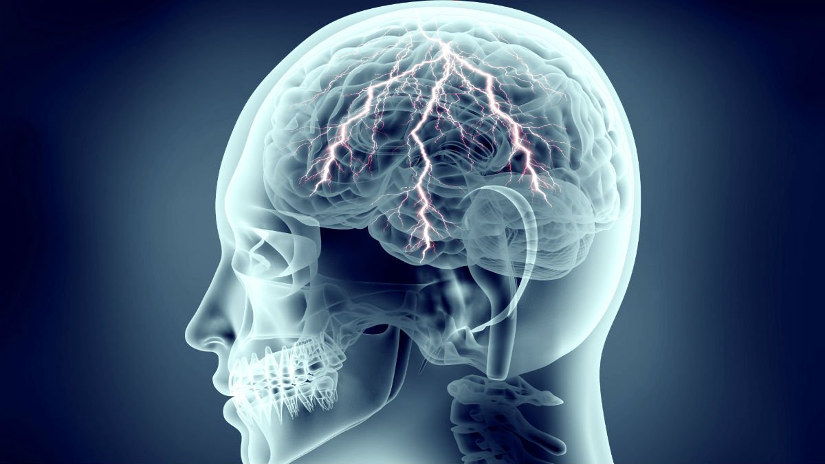 X-ray of human brain