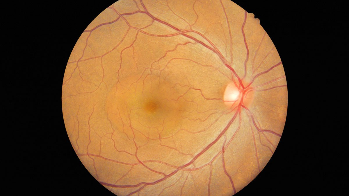 Retinal scan