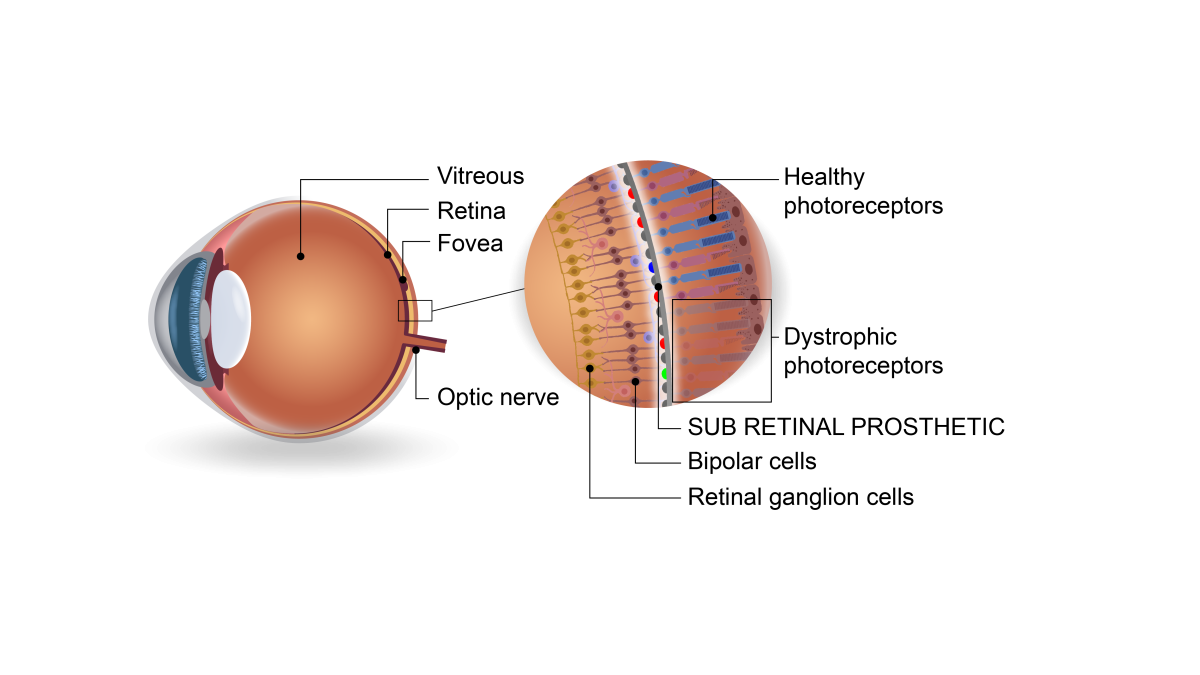 Full colour artificial retina schematic
