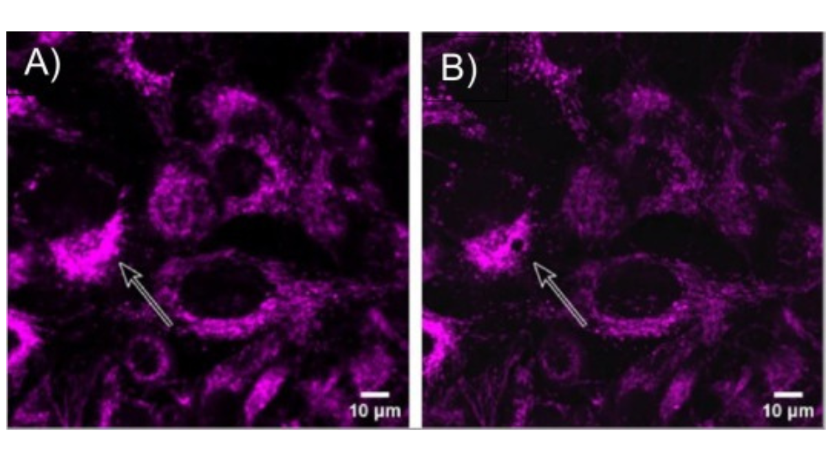 Fluorescently dyed mitochondrial material shown A) before and B) after sampling, demonstrating the capabilities of the Yokogawa SS2000 to extract subcellular components.